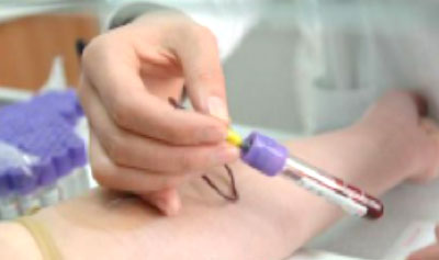 怎么做亲子鉴定