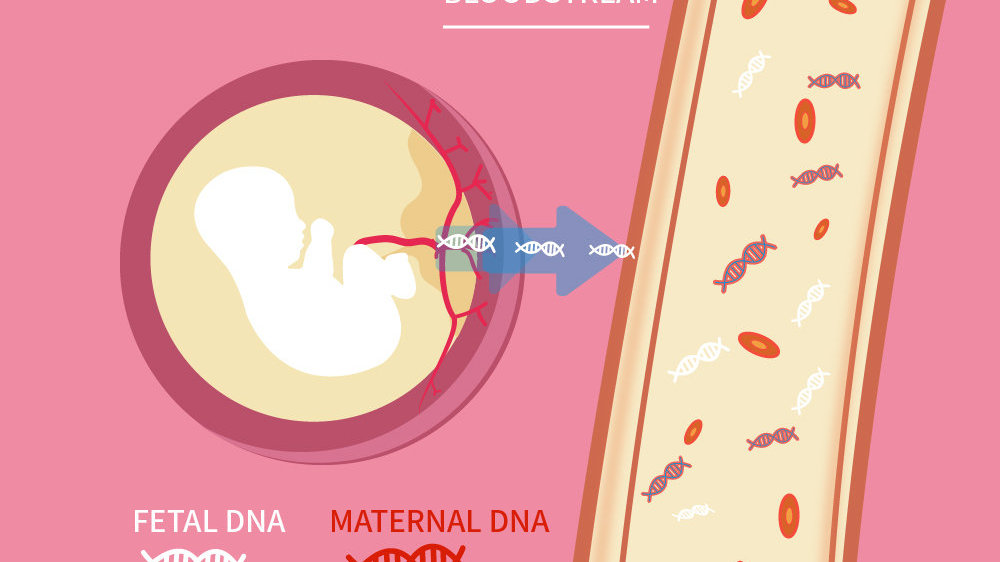 无创产前亲子鉴定