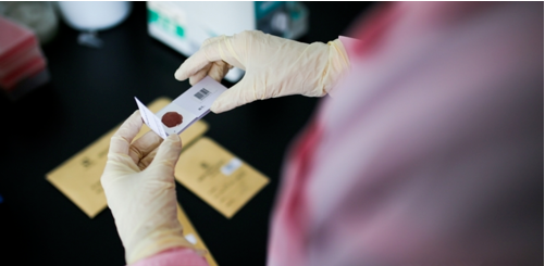 亲子鉴定需要多少钱