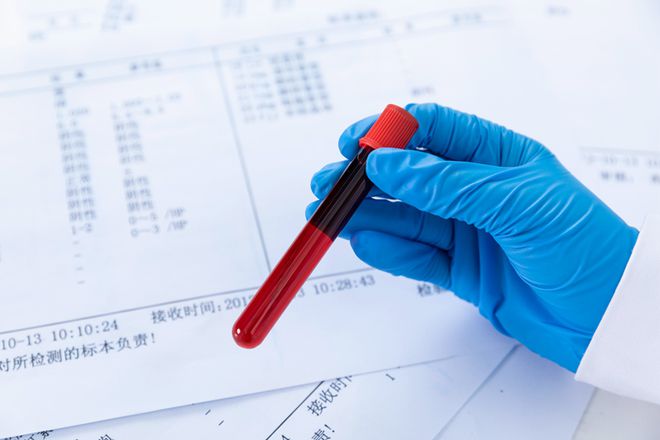 亲子鉴定多少钱