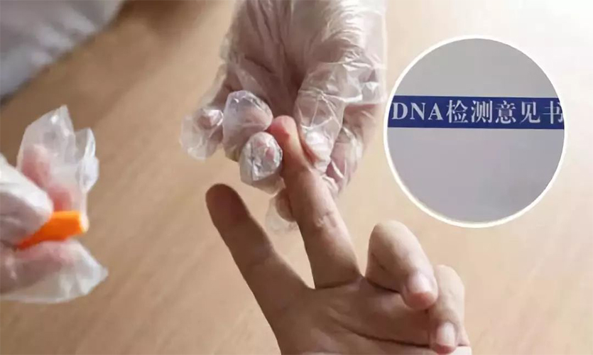 亲子鉴定多少费用