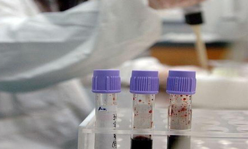 亲子鉴定需要什么