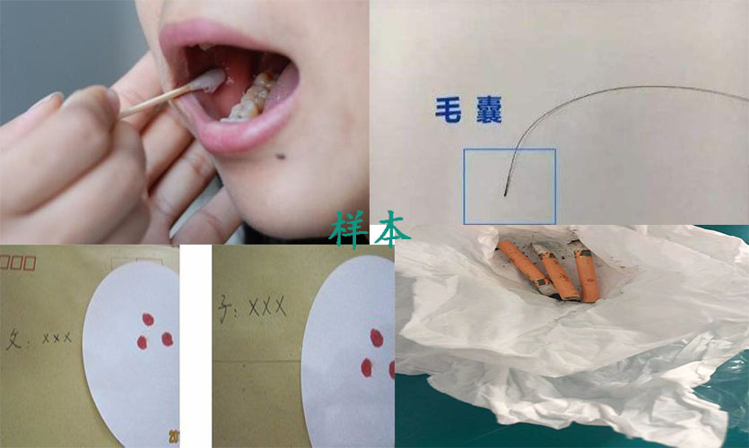 亲子鉴定多少钱