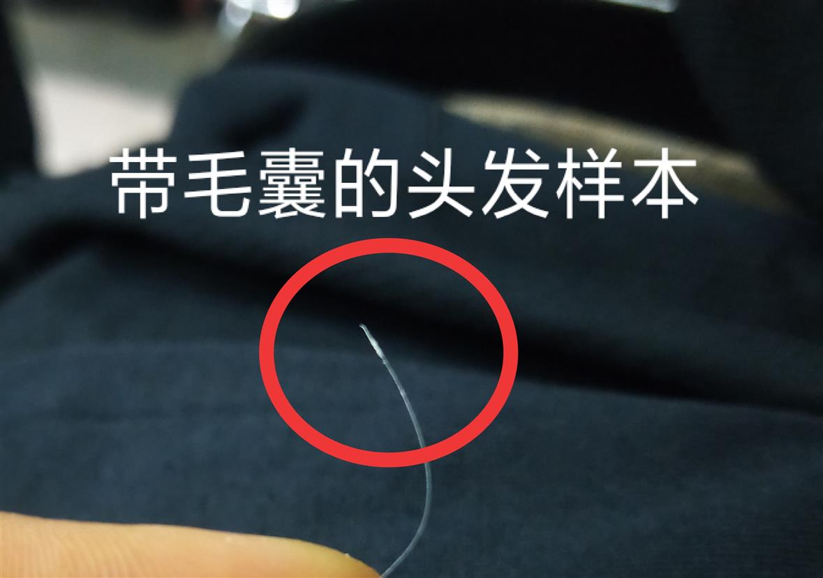 头发可以做亲子鉴定